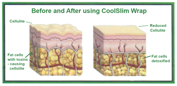 CoolSlim Body Wrap Tightens And Tones. Lose inches in 30 minutes!