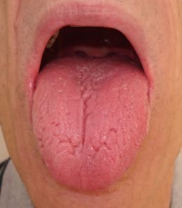 What does your tongue say about your health